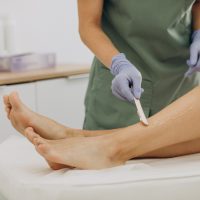 Laser epilation, hair removal therapy